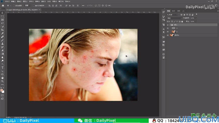 Photoshop人像美容教程：利用高低频操作快速去除美女人像脸部的红斑。