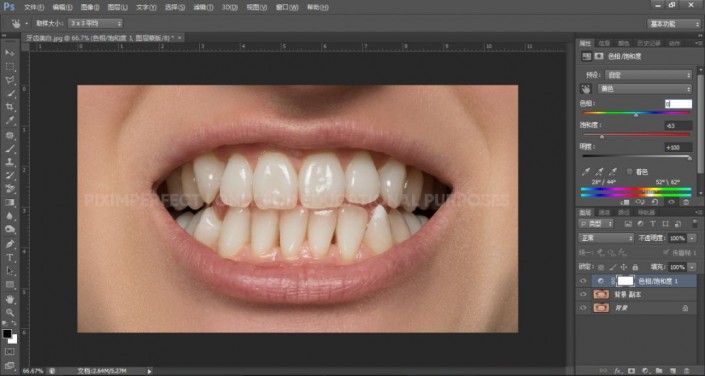 牙齿美化，超级有效的美白牙齿方法