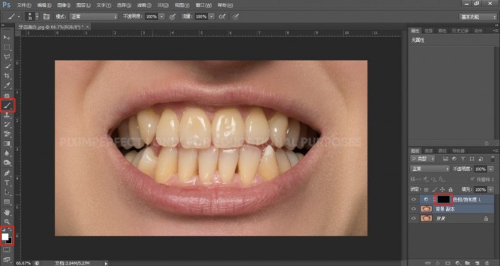 牙齿美化，超级有效的美白牙齿方法