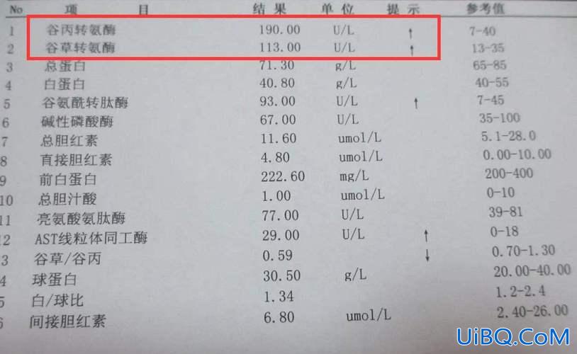 儿童会肝功异常能升学吗(乙肝肝功能不正常能上大学吗要是体检查出来了会不会被退学)？
