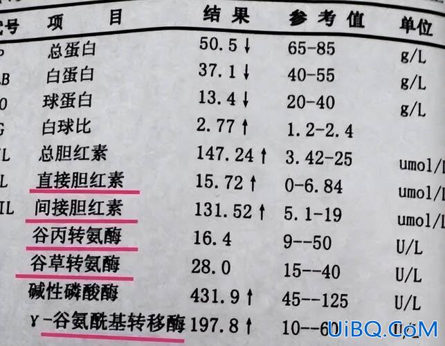 有肝炎会影响升学吗高考，转氨酶高但没有肝炎对高考录取有影响吗？